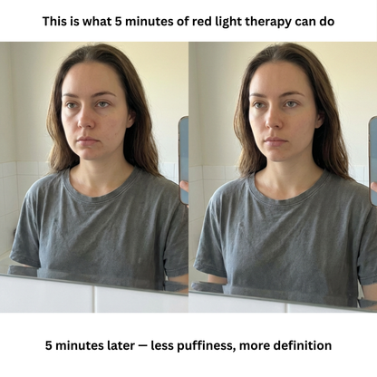 GlowSculpt™ Red Light Therapy Facial Massager