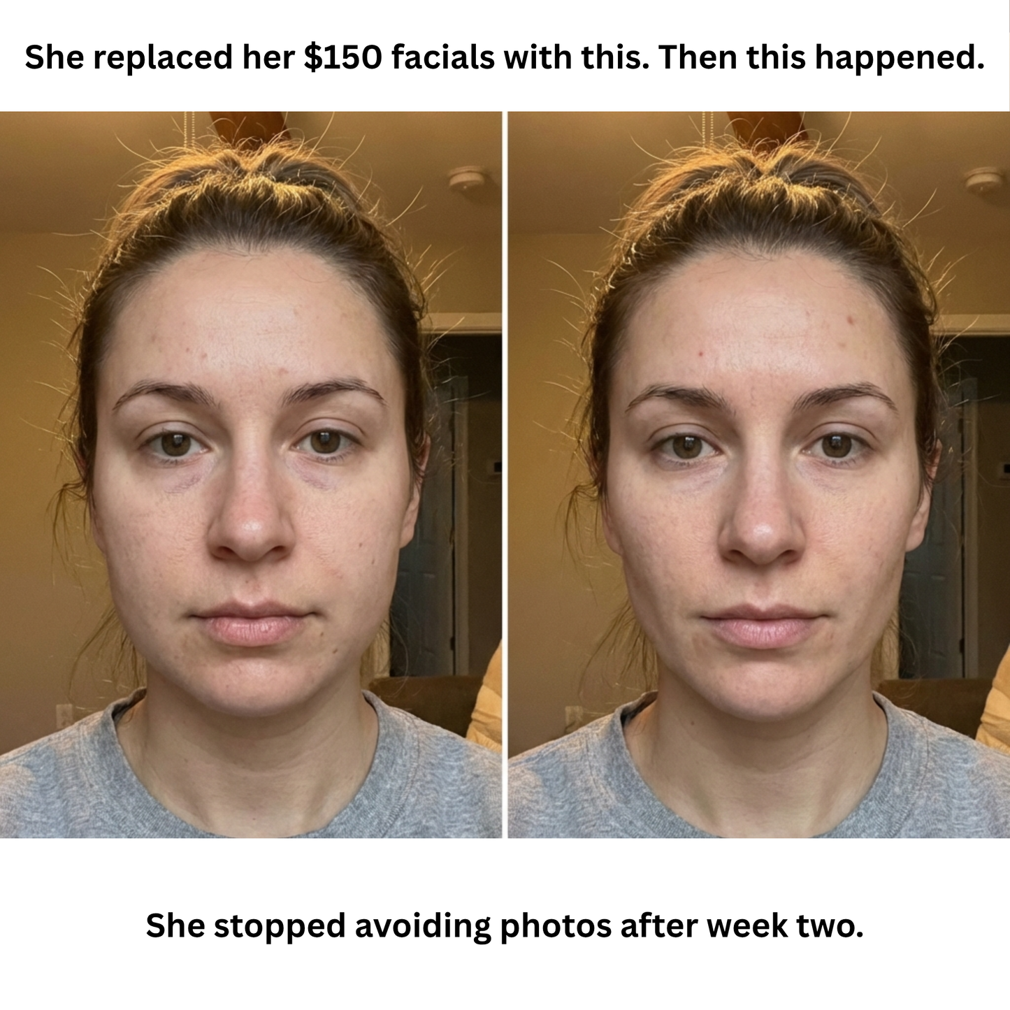GlowSculpt™ Red Light Therapy Facial Massager