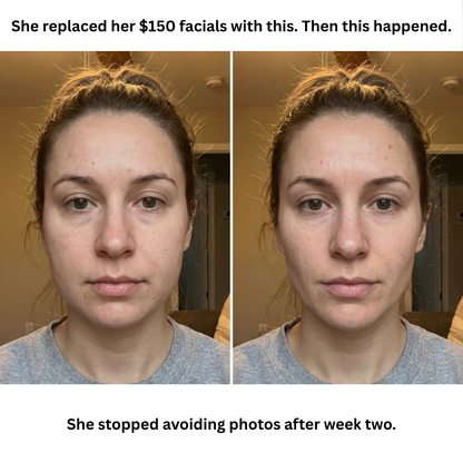 GlowSculpt™ Red Light Therapy Facial Massager